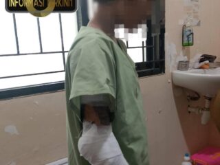Tragis! Remaja di Tambak Lorok Diduga Dibakar Kerabat, Polisi Sigap Beri Pendampingan
